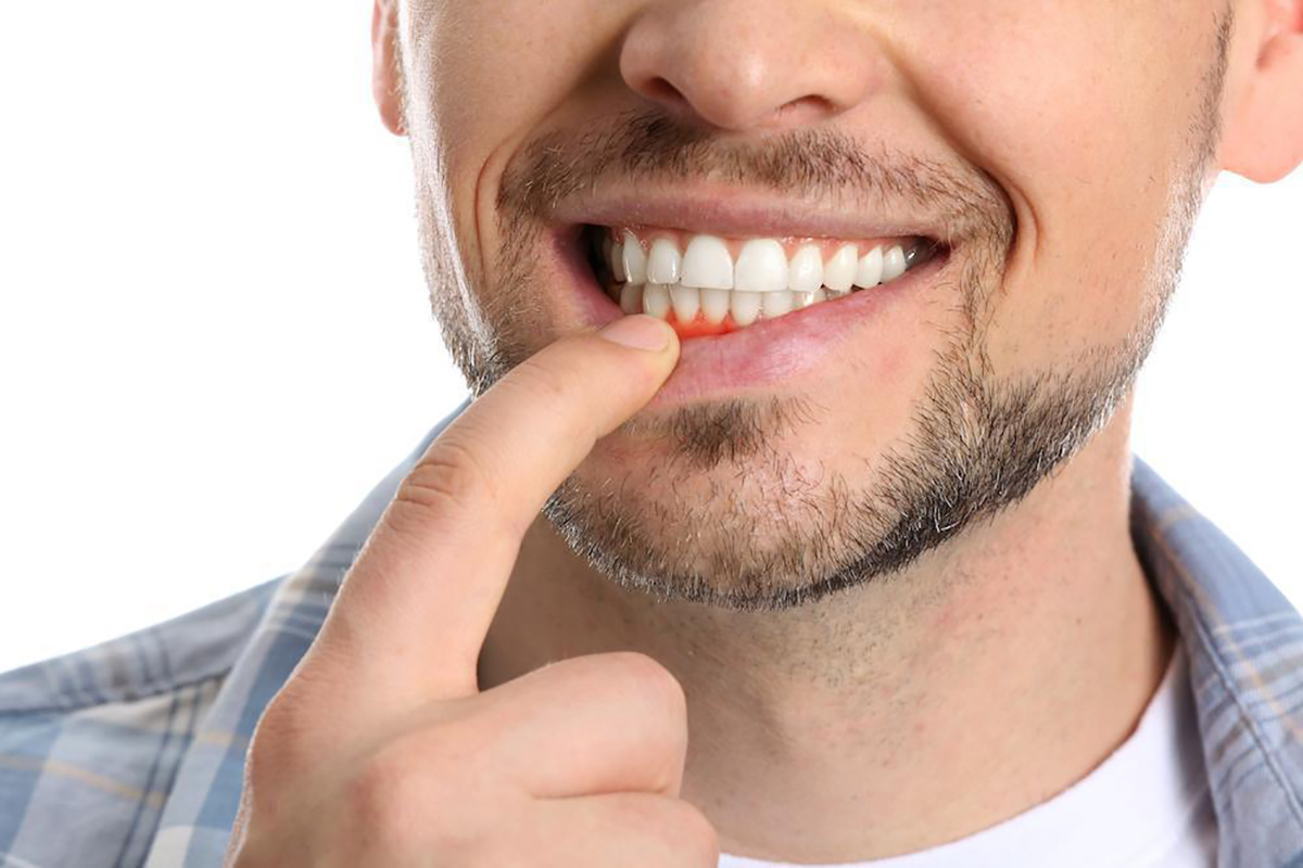 cavity risks