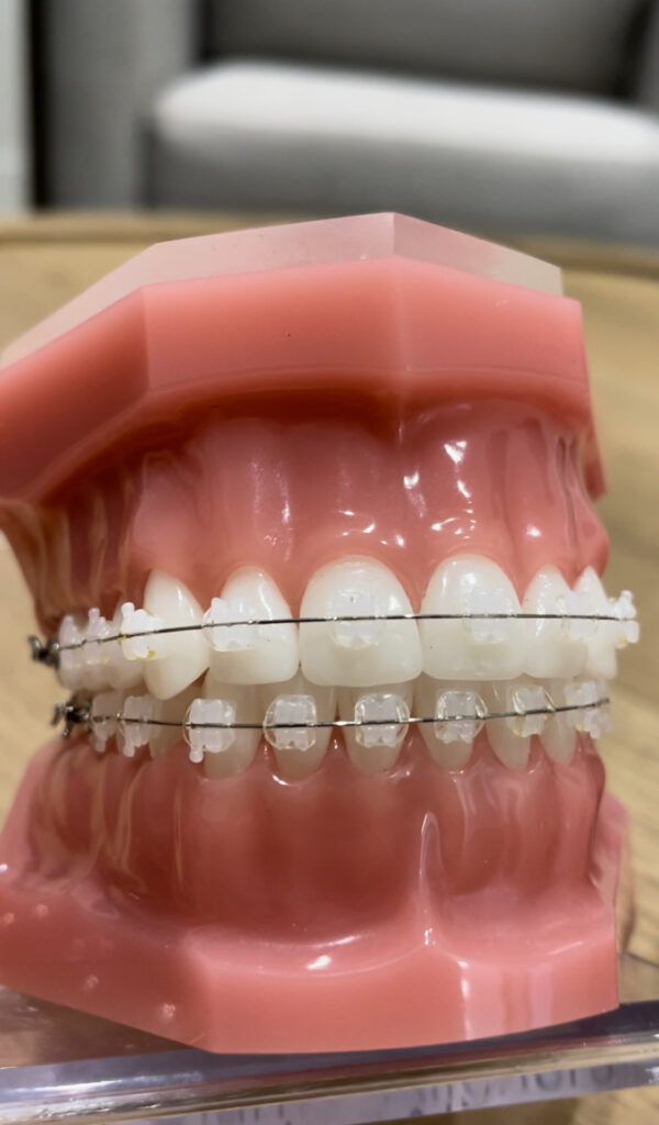 Braces in Davis County