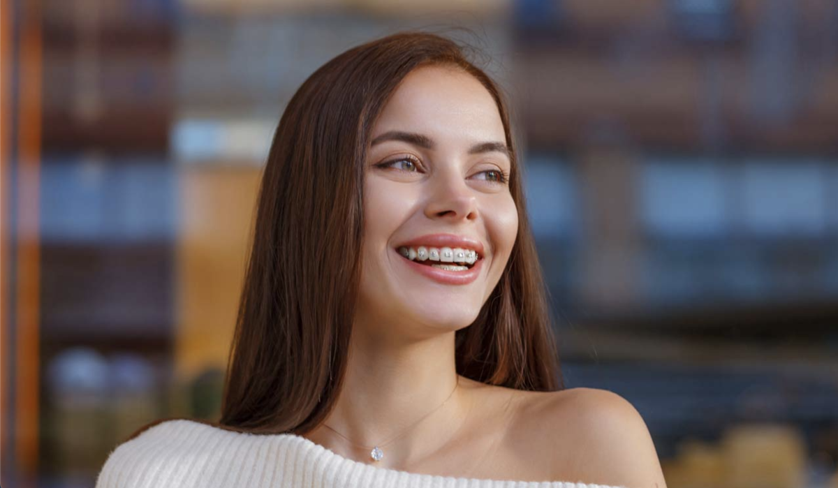 Braces in Davis County