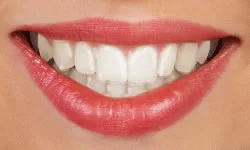 Braces in Davis County