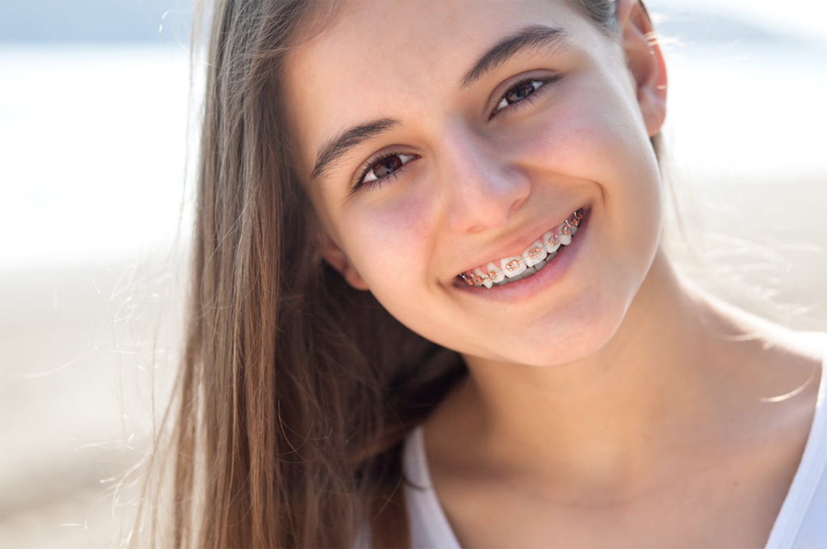 Braces in Kaysville Utah